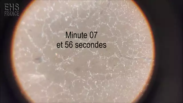 Vaccin ARNm Pfizer analysé au microscope 11 mn à une température de 30°